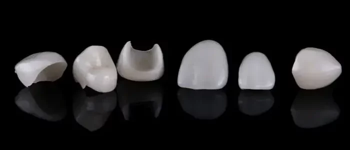 Diseño sonrisa Barajas